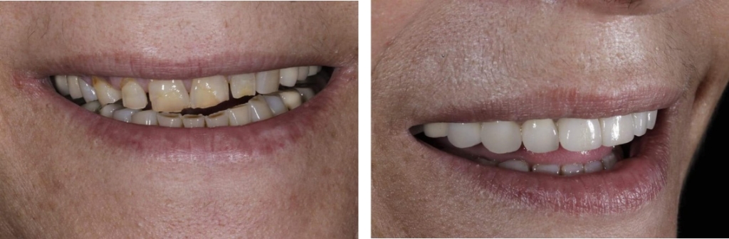 OUR WORK, DENTA LIFE
