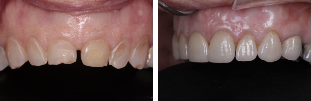 OUR WORK, DENTA LIFE