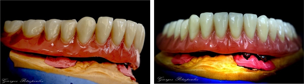 OUR WORK, DENTA LIFE