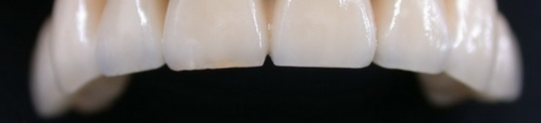 FIXED PROSTHODONTICS, DENTA LIFE