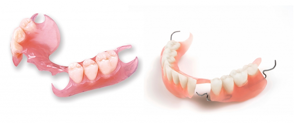 REMOVABLE DENTURES, DENTA LIFE
